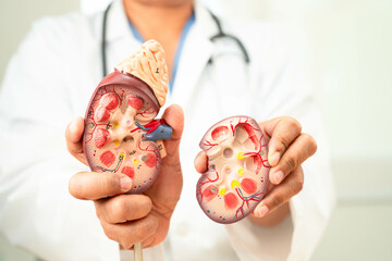 Chronic kidney disease, doctor with model for treatment urinary system, urology, Estimated...