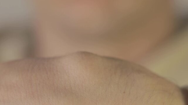 Hygroma of the man's wrist. Ganglion cyst on hand. Close up.