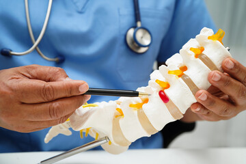 Doctor with lumbar vertebra bone skeleton and nerve model for treatment in the orthopedic...