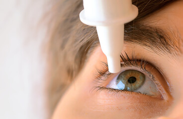 woman applying eye drop. Vitamin drops from tiredness and redness eyes. Suffering from irritated...
