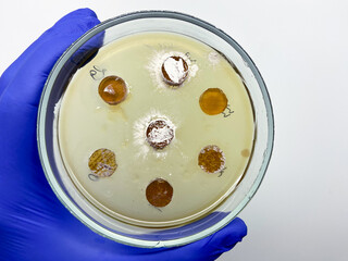 Bacterial colony zones on a Petri dish, scientist showing bacterial cultures on a white background.