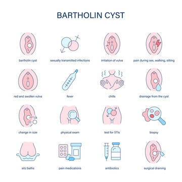 Bartholin Cyst symptoms, diagnostic and treatment vector icons. Medical icons.