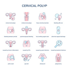 Cervical Polyp symptoms, diagnostic and treatment vector icons. Medical icons.