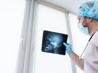 Human skull on x-ray or ultrasound. Doctor in the office studying diseases of the central and...