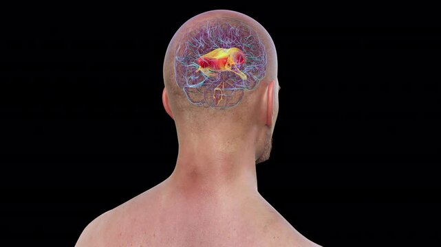 Human brain with highlighted corpus callosum connecting brain hemispheres, and ventricles adjacent to the corpus callosum, vital for cerebrospinal fluid circulation, 3D animation.