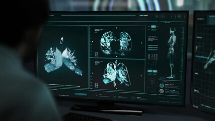 Doctor Using Innovative Hospital Computer To Scan Lungs Of Ill Patient. Doctor Checks Lungs Of Patient In High Tech Hospital Computer. Doctor Diagnosed Coronavirus In Hospital Computer Interface - Powered by Adobe