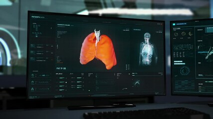 Visualization Of Lungs In Modern medical Scientific Software On Computer Screen. Scientific Analysis Of Data To Make Covid-19 Diagnosis. Scientific Research Of Health Condition. Data From CT Scans. - Powered by Adobe