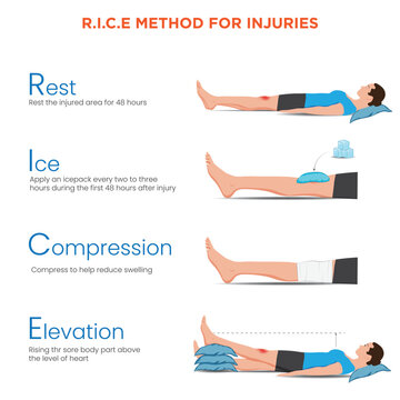 R.I.C.E Method for Injuries Rest, Ice, Compression, and Elevation for Quick Recovery