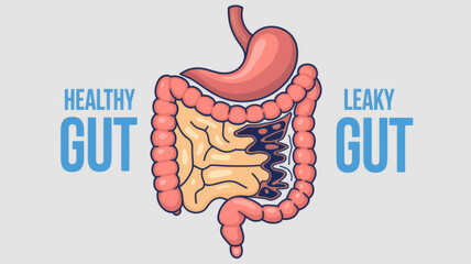 Detailed Diagram of Healthy Gut vs. Leaky Gut, Highlighting Intestinal Permeability