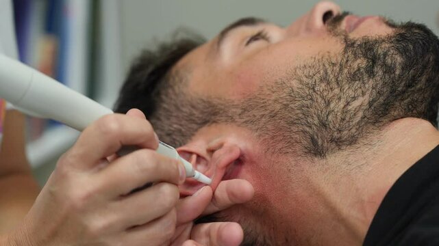 Dry Needling. Inserting small needle in the ear trigger points