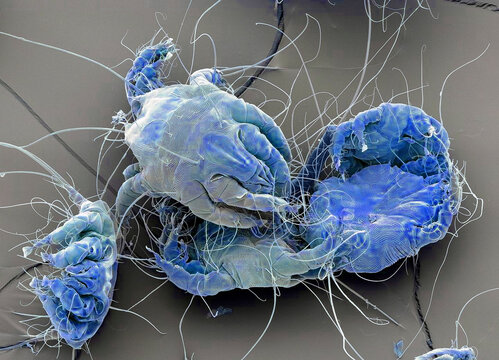 Dust mites, SEM