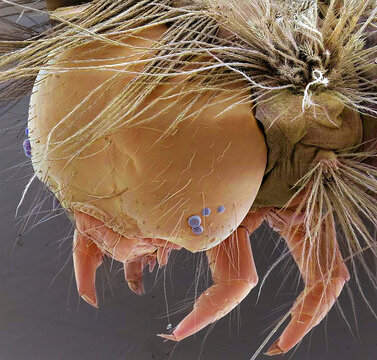 Vapourer moth caterpillar, SEM