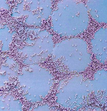 Brochosomes, SEM