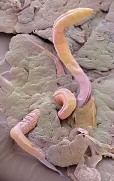C. elegans, SEM