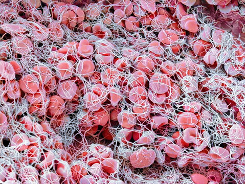 Blood clot, SEM