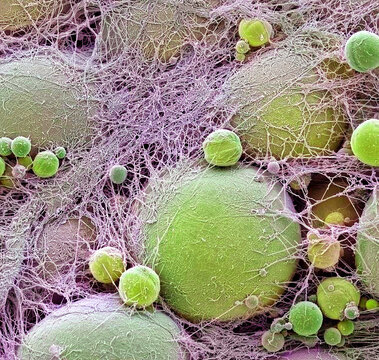 Fat cells, SEM