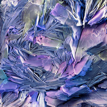 Gallstone crystals, SEM