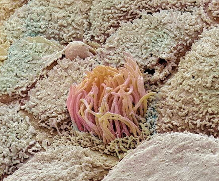 Uterus, SEM