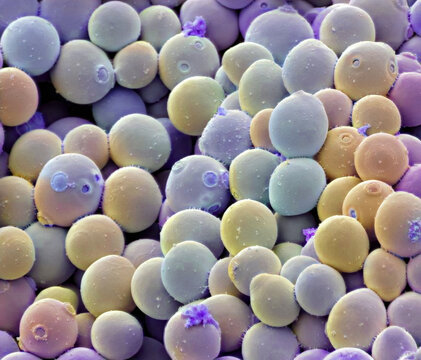 Yeast cells, SEM