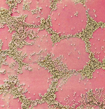 Brochosomes, SEM