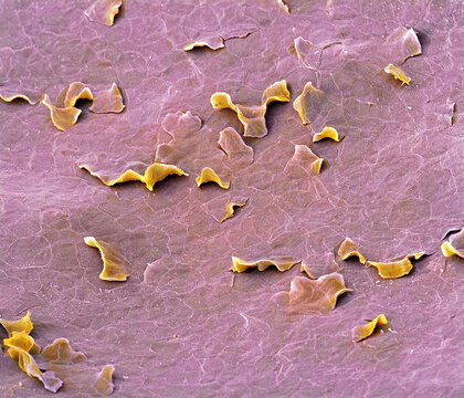 Hard palate lining, SEM
