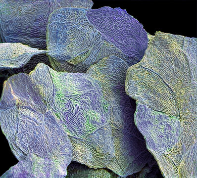 Skin cells, SEM