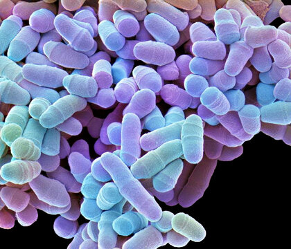 Schizosaccharomyces pombe yeast, SEM