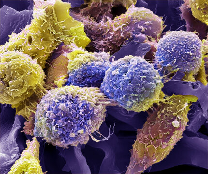HeLa cells, SEM