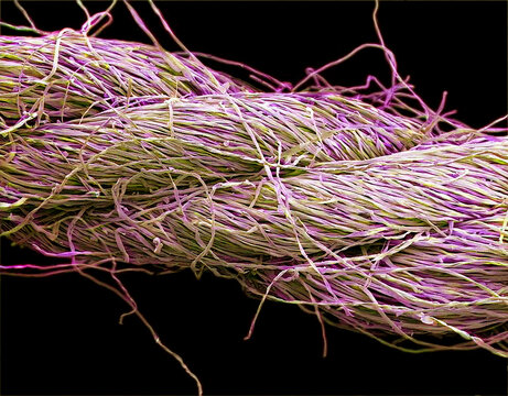 Viscose fibres from a tampon, SEM