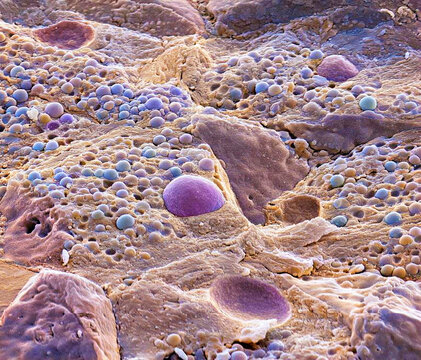 Pancreas tissue, SEM