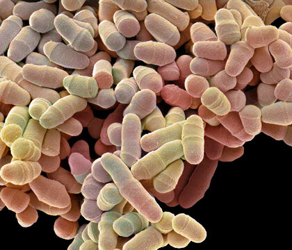 Schizosaccharomyces pombe yeast, SEM