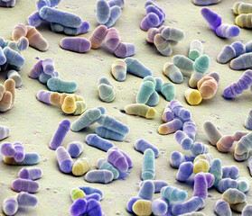 Schizosaccharomyces pombe yeast, SEM