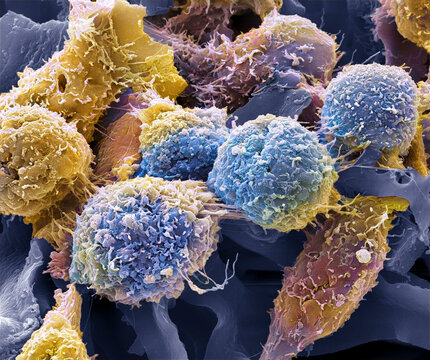HeLa cells, SEM