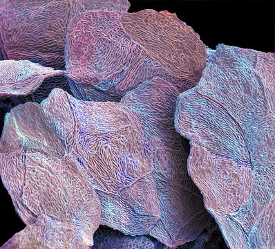 Skin cells, SEM