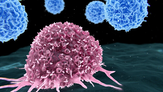 Tumour infiltrating lymphocyte therapy, illustration
