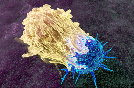 Macrophage attacking a cancer cell, illustration