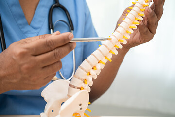 Asian doctor holding spinal nerve and bone model, Lumbar spine displaced herniated disc fragment...