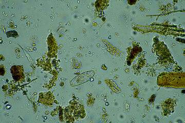 soil fungi storing carbon in the soil. testate amoebae and bacteria cycling nutrients. regenerative...