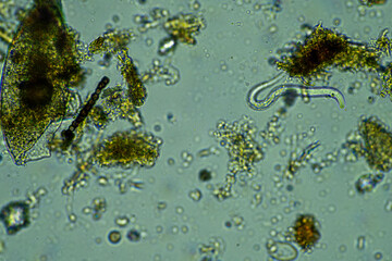 soil fungi storing carbon in the soil. testate amoebae and bacteria cycling nutrients. regenerative agriculture sustainable practices growing healthy food on farms and in crops