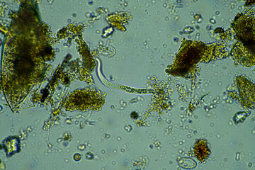soil fungi storing carbon in the soil. testate amoebae and bacteria cycling nutrients. regenerative agriculture sustainable practices growing healthy food on farms and in crops