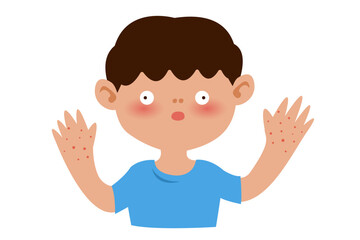 hand foot and mouth Disease symptoms. vector illustration