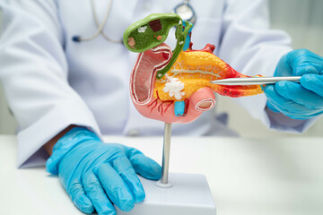Pancreatitis, pancreatic cancer, Asian doctor with pancreas, gallbladder and bile duct human...