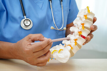 Asian doctor holding spinal nerve and bone model, Lumbar spine displaced herniated disc fragment...