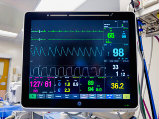 hospital monitors displaying vital signs, including heart rate, oxygen levels, and blood pressure....