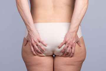 Close-up rear view of the buttocks of a slightly overweight woman with cellulite and her hands grasping the fat of the buttocks. Concept of woman, cellulite, overweight and diet
