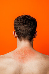 Naklejka premium Man showing sunburn on back, orange background