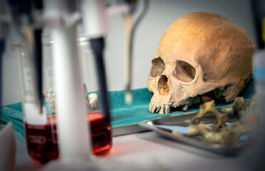 Several human skulls next to petri dish with bone remains to determine DNA in forensic laboratory
