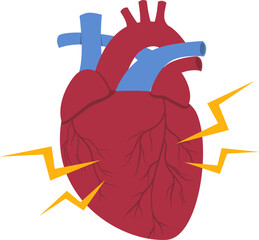 Heart disease illustration. Cardiovascular disease illustration.