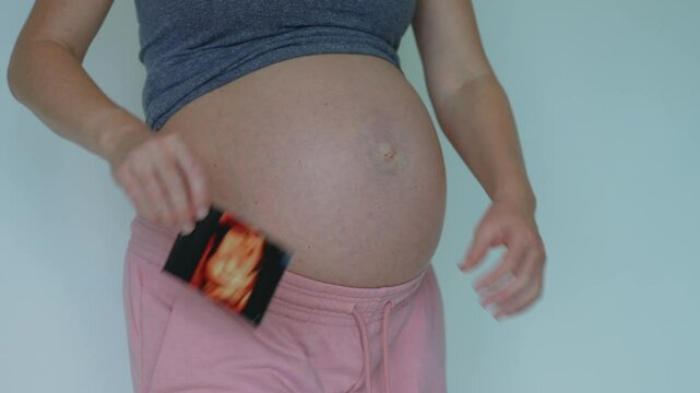 A close-up of a pregnant woman's belly as she proudly shows a 3D ultrasound image of her unborn child. This intimate moment captures the joy and anticipation of motherhood, emphasizing the bond