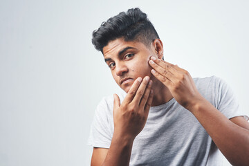 Indian man, portrait and skin with acne for condition or allergic reaction on a white studio background. Young, male person or gen z model with check for pigmentation, spot or imperfection on space